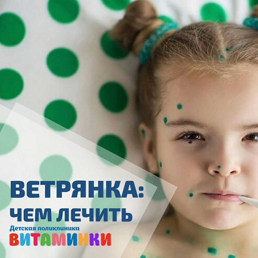 Ветрянка: чем лечить | Детская поликлиника «Витаминки»